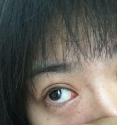 小仓鼠眼白揭秘（探索小仓鼠眼白的形态特征和功能机制）