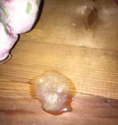 狗狗肠道出血的原因及预防措施（了解肠道出血，让我们的狗狗健康无忧）