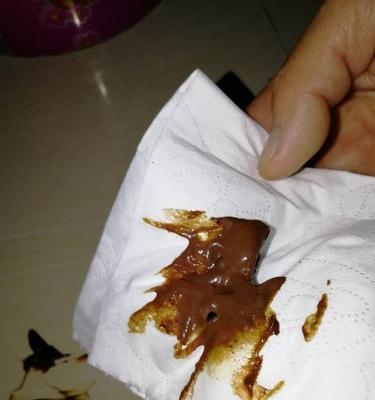 深夜呕吐背后的原因及处理方法（半夜吐了，这背后到底隐藏了什么？如何应对？）
