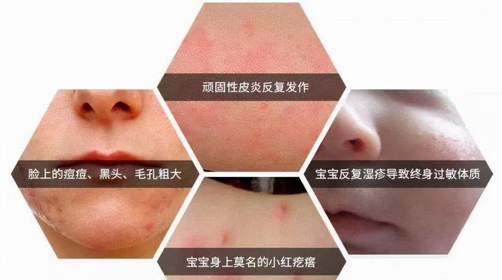 兔兔为什么容易得螨虫病？（螨虫病对兔兔的危害有多大？）