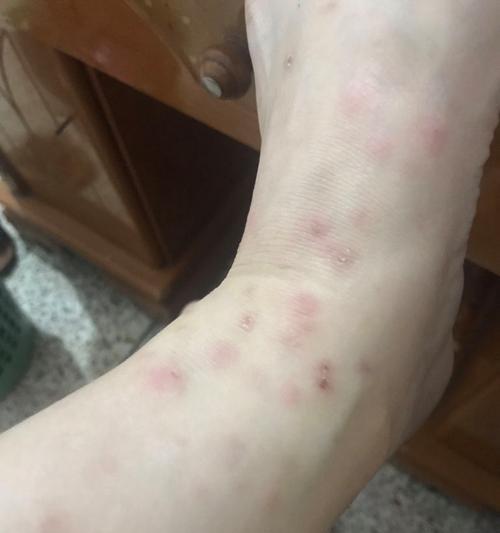 虱子离开猫后的生存能力究竟有多强？（探索虱子在离开猫体后的生存时间、方式和影响因素）