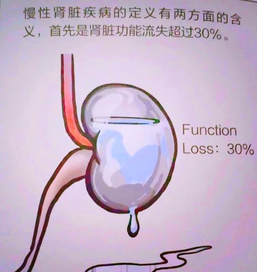 揭秘猫肾衰晚期症状（猫肾衰晚期症状及护理方法一览）