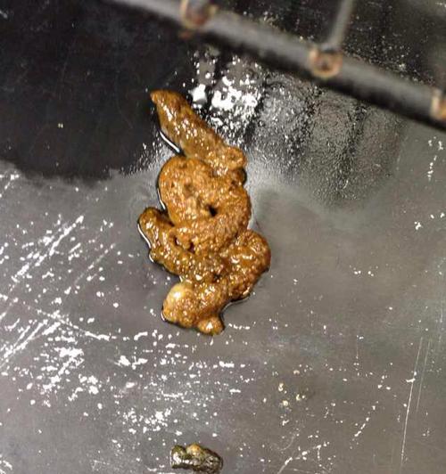 拜耳食品中的虫子与消化周期（拜耳食品中的虫子在人体中的寄生和排出过程）