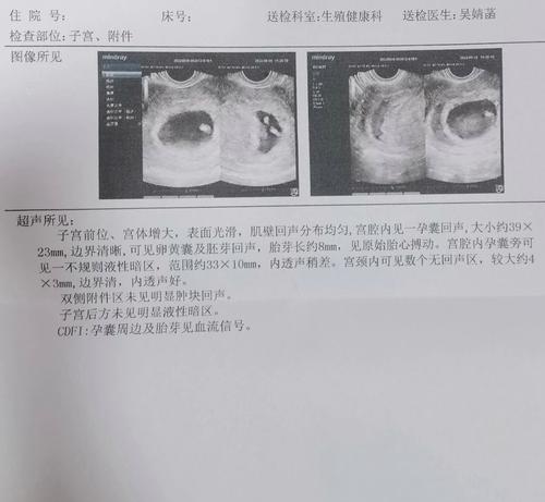 怀孕多久可以看到？（探寻怀孕初期的体征和时间线）